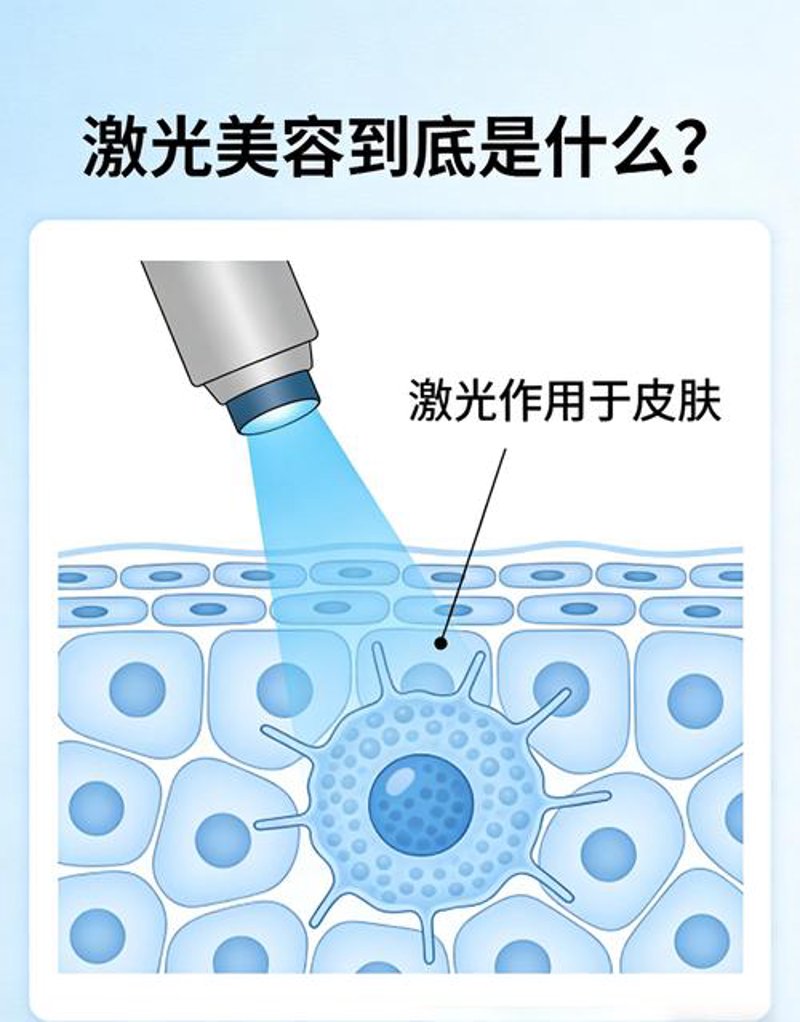 激光美容